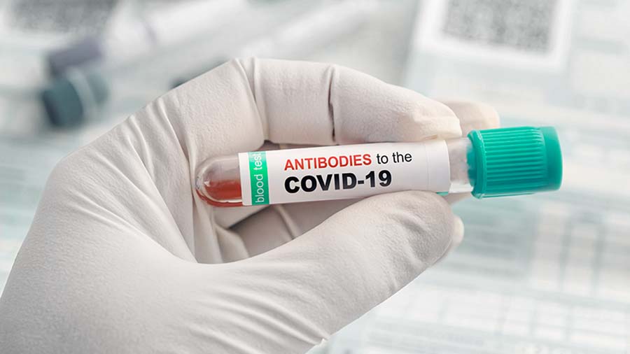 COVID-19 Test - Antibody